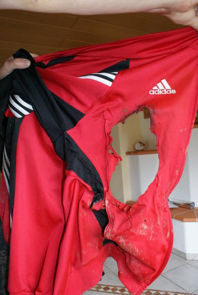 ... die rote Jacke mit dem fußballgroßen Loch ...