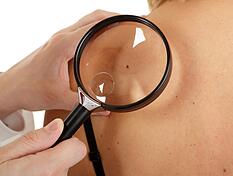 Alle zwei Jahre zur Hautkrebs-Vorsorge zu gehen, kann lebensrettend sein.