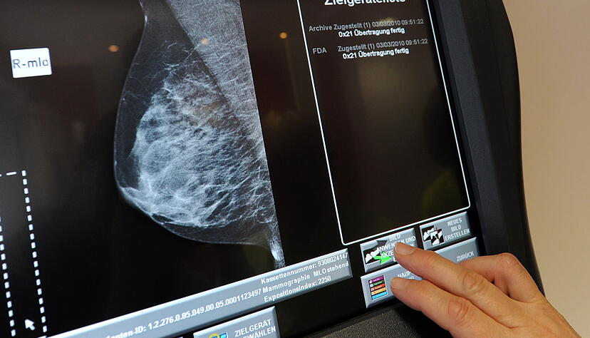 Das Brustkrebs-Screening wurde im Jahr 2009 flächendeckend in Deutschland eingeführt.