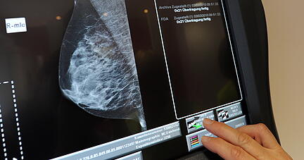 Das Brustkrebs-Screening wurde im Jahr 2009 flächendeckend in Deutschland eingeführt.
