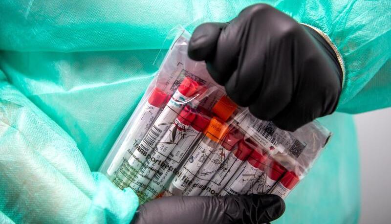 Proben für einen PCR-Test werden von einem Laboranten verpackt. Themenfoto: dpa
