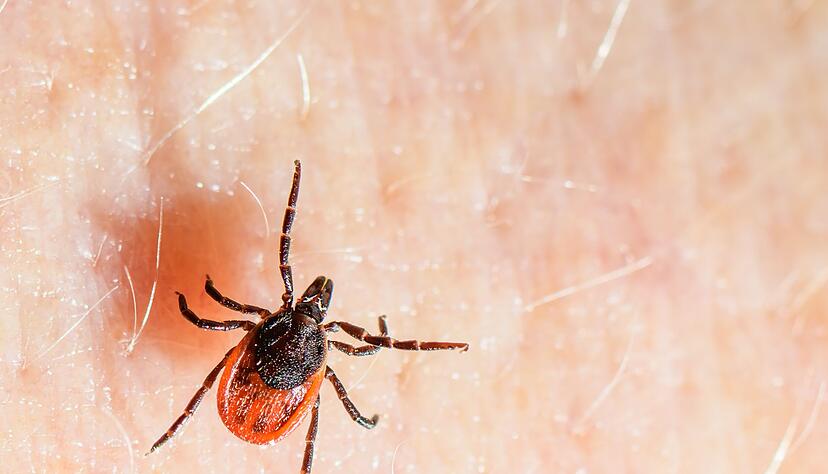 Der Gemeine Holzbock ist die h&auml;ufigste Zeckenart in Deutschland und auch die, die haupts&auml;chlich FSME und Borreliose auf den Menschen &uuml;bertragt. (Archivbild)