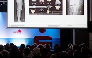 Wenn Knochen auf Knochen reibt: Dr. Burkhard Schropp erläuterte den über 300 Zuhörern bei der 46. Abendvorlesung Ursachen und Folgen einer Arthrose. Wenn Knochen auf Knochen reibt: Dr. Burkhard Schropp erläuterte den über 300 Zuhörern bei der 46. Abendvorlesung Ursachen und Folgen einer Arthrose.