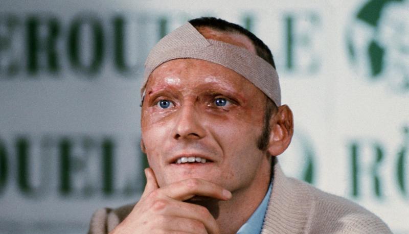 Niki Lauda gibt 1976 rund fünf Wochen nach seinem schweren Rennunfall auf dem Nürburgring eine Pressekonferenz. Niki Lauda gibt 1976 rund fünf Wochen nach seinem schweren Rennunfall auf dem Nürburgring eine Pressekonferenz.