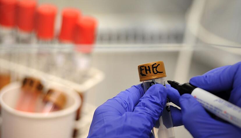 Rinder-Salami wird wegen einer m&ouml;glichen bakteriellen Belastung zur&uuml;ckgerufen. (Symbolbild)