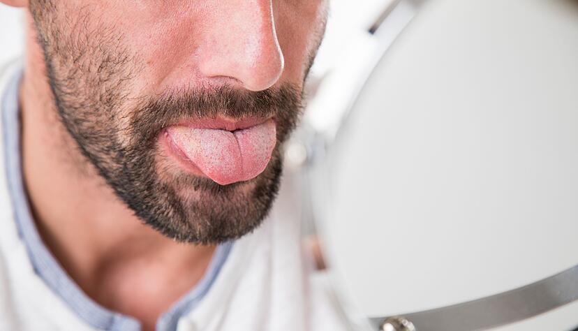 Wer sich regelmäßig gründlich die Zähne putzt und die Zunge mit einem speziellen Schaber reinigt, lässt schädlichen Ablagerungen kaum eine Chance. Wer sich regelmäßig gründlich die Zähne putzt und die Zunge mit einem speziellen Schaber reinigt, lässt schädlichen Ablagerungen kaum eine Chance.