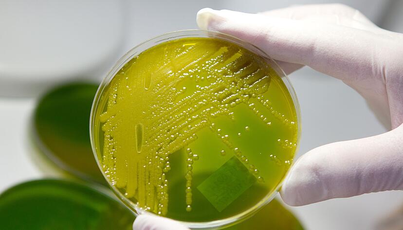Ehec steht für enterohämorrhagische Escherichia coli und bezeichnet bestimmte krankmachende Stämme des Darm-Bakteriums, die vor allem bei Wiederkäuern wie Rindern vorkommen. (Archivbild) Ehec steht für enterohämorrhagische Escherichia coli und bezeichnet bestimmte krankmachende Stämme des Darm-Bakteriums, die vor allem bei Wiederkäuern wie Rindern vorkommen. (Archivbild)