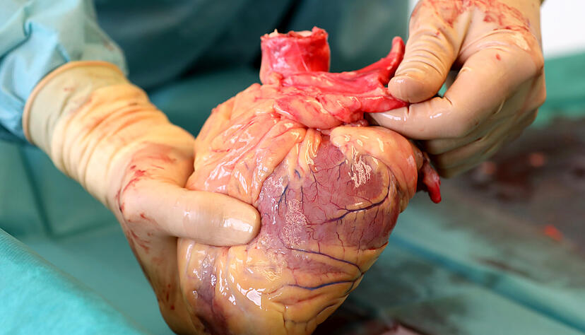 Nach der Entscheidung des Bundestags &uuml;ber Organspenden erreichen unsere Redaktion viele Reaktionen von Lesern. Foto: dpa