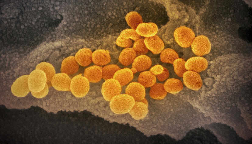 Eine elektronenmikroskopische Aufnahme des "U.S. National Institute of Health" zeigt das neuartige Coronavirus (Sars-Cov-2), das aus der Oberfläche von im Labor kultivierten Zellen austritt. Das Virus passt sich durch Mutationen ständig seinem neuen Wirt, dem Menschen an.
