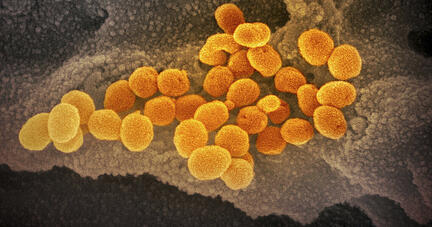 Eine elektronenmikroskopische Aufnahme des "U.S. National Institute of Health" zeigt das neuartige Coronavirus (Sars-Cov-2), das aus der Oberfläche von im Labor kultivierten Zellen austritt. Das Virus passt sich durch Mutationen ständig seinem neuen Wirt, dem Menschen an.