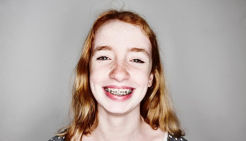 Zahnspange ist nicht gleich Zahnspange: Familien haben die Wahl zwischen der Kassen-Variante und einem Modell mit zahlreichen Extras.