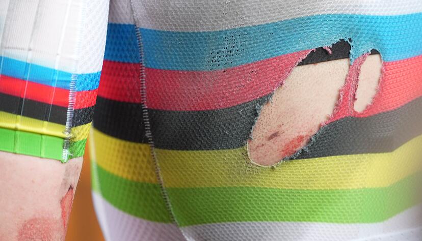 Die Folgen des Sturzes von Tadej Pogacar.