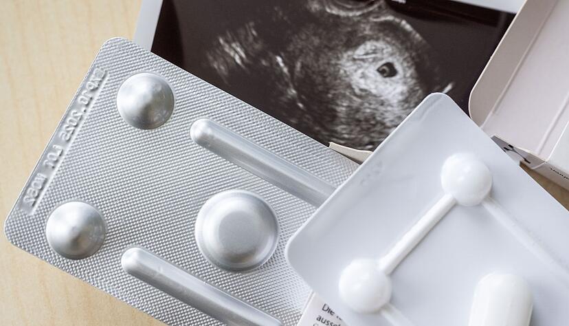 Zum ersten Mal wurde bei Schwangerschaftsabbr&uuml;chen das Medikament Mifegyne h&auml;ufiger genutzt als die Absaugmethode. (Archivbild)