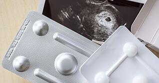 Zum ersten Mal wurde bei Schwangerschaftsabbr&uuml;chen das Medikament Mifegyne h&auml;ufiger genutzt als die Absaugmethode. (Archivbild)