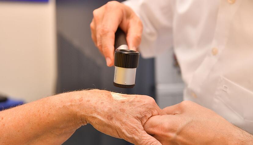 Dermatologische Praxen bieten verschiedene Methoden an, um Altersflecken dauerhaft zu entfernen. Dermatologische Praxen bieten verschiedene Methoden an, um Altersflecken dauerhaft zu entfernen.