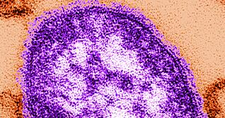 In den USA wurden seit Anfang des Jahres fast 1000 Masern-F&auml;lle gemeldet.