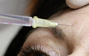Spitzenreiter bei den Eingriffen ist Botox, das vor allem im Stirn- und Augenbereich eingesetzt wird. 24.000 Behandlungen gab es im vergangenen Jahr in Deutschland. Foto: dpa Spitzenreiter bei den Eingriffen ist Botox, das vor allem im Stirn- und Augenbereich eingesetzt wird. 24.000 Behandlungen gab es im vergangenen Jahr in Deutschland. Foto: dpa