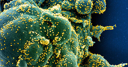 Auf dieser vom US-Forschungszentrum «National Institute of Allergy and Infectious Diseases» (NIAID) zur Verfügung gestellten Aufnahme  ist eine Zelle (grün) mit dem Coronavirus (SARS-CoV-2, gelb) infiziert. Die Probe wurde von einem Patienten in den USA isoliert.  Foto: Niaid/Europa Press/dpa