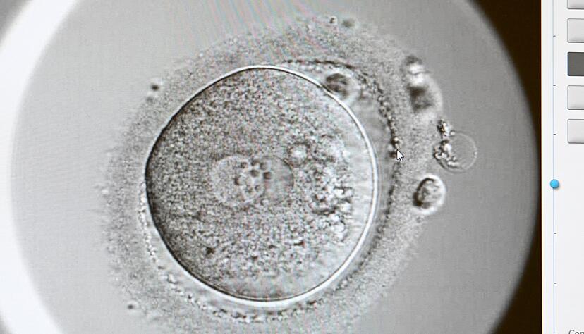 Expertinnen raten: Wer Endometriose und einen Kinderwunsch hat, sollte mit einer Kinderwunschbehandlung nicht zu lange warten, wenn es auf nat&uuml;rlichem Wege nicht klappt.