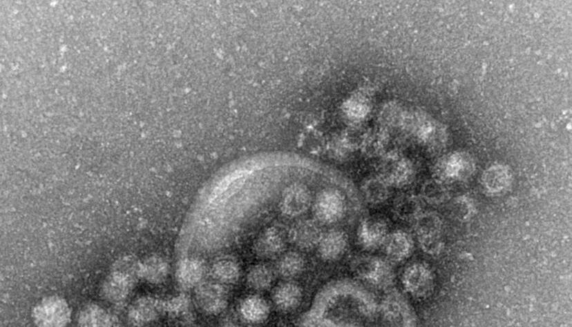 Das hochansteckende Norovirus verursacht einen plötzlich auftretenden, heftigen Brechdurchfall. Das hochansteckende Norovirus verursacht einen plötzlich auftretenden, heftigen Brechdurchfall.