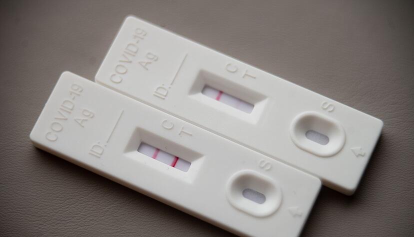 Viele Infektionen bleiben unerkannt, weil weniger getestet wird als noch vor einigen Jahren. Viele Infektionen bleiben unerkannt, weil weniger getestet wird als noch vor einigen Jahren.
