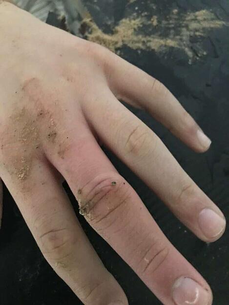 Ein 14-J&auml;hriger steckte mit seinem Mittelfinger im Loch einer Tischplatte fest. Die Feuerwehr befreite den Teenager.