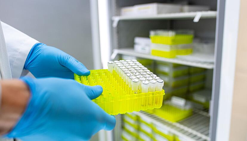 Ehec ist meldepflichtig. (Archivbild)