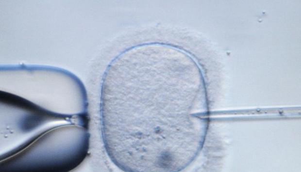 Die mikroskopische Aufnahme zeigt eine menschliche Eizelle, die in einem Speziallabor zu Demonstrationszwecken injiziert wird. Foto: Ralf Hirschberger/Archiv