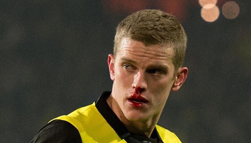 Der Dortmunder Sven Blender zog sich einen Nasenbeinbruch zu. Foto: Bernd Thissen