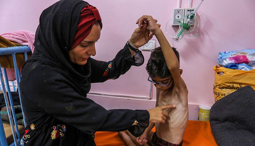 Kinder unter f&uuml;nf Jahren sind bei Mangelern&auml;hrung in Lebensgefahr. (Archivbild)