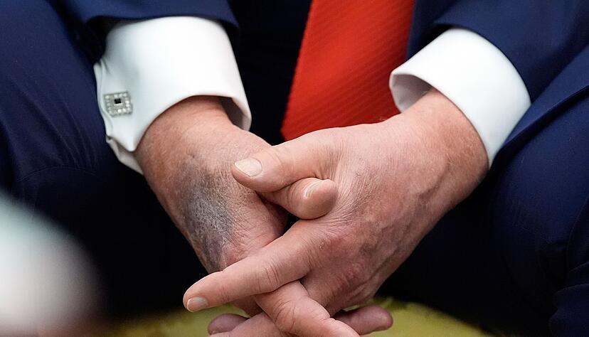 Blaue Flecken geben immer wieder Anlass f&uuml;r Spekulationen. (Archivbild)