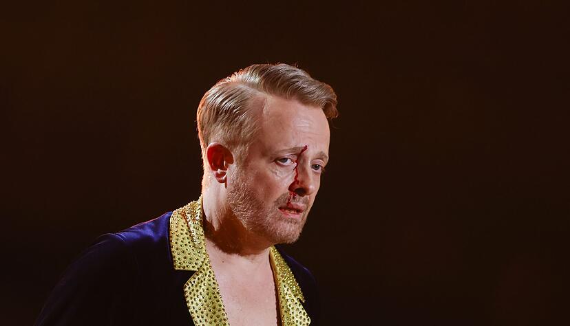 Ross Antony war sichtlich gezeichnet, nahm die Sache aber mit Humor.