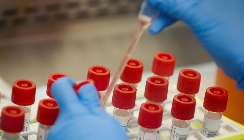 Etliche Labors weltweit forschen derzeit an Impfstoffen gegen Covid-19. In einem Forschungsinstitut in Seattle wird bereits eine Testsubstanz an einem Freiwilligen erprobt.