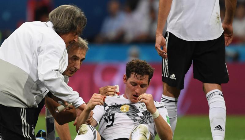 Sebastian Rudy musste stark aus der Nase blutend ausgewechselt werden. Foto: Ina Fassbender