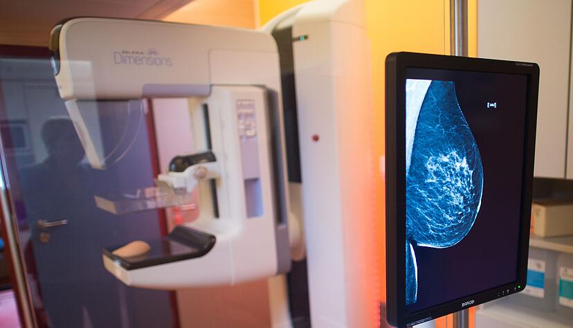 Etwa 18.500 Frauen jährlich sterben an Brustkrebs - ohne Mammographie-Screening-Programm wären es Schätzungen zufolge mehrere Tausend mehr. (Archivbild) Etwa 18.500 Frauen jährlich sterben an Brustkrebs - ohne Mammographie-Screening-Programm wären es Schätzungen zufolge mehrere Tausend mehr. (Archivbild)