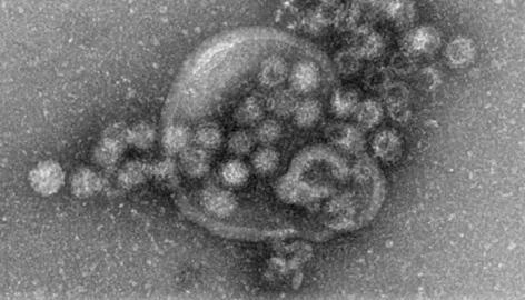 Elektronenmikroskopische Aufnahme von Noroviren. Elektronenmikroskopische Aufnahme von Noroviren.