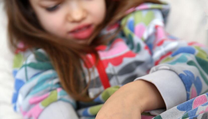 Das ist fies an Hautausschlägen: Einige von ihnen jucken wie verrückt. Das ist fies an Hautausschlägen: Einige von ihnen jucken wie verrückt.