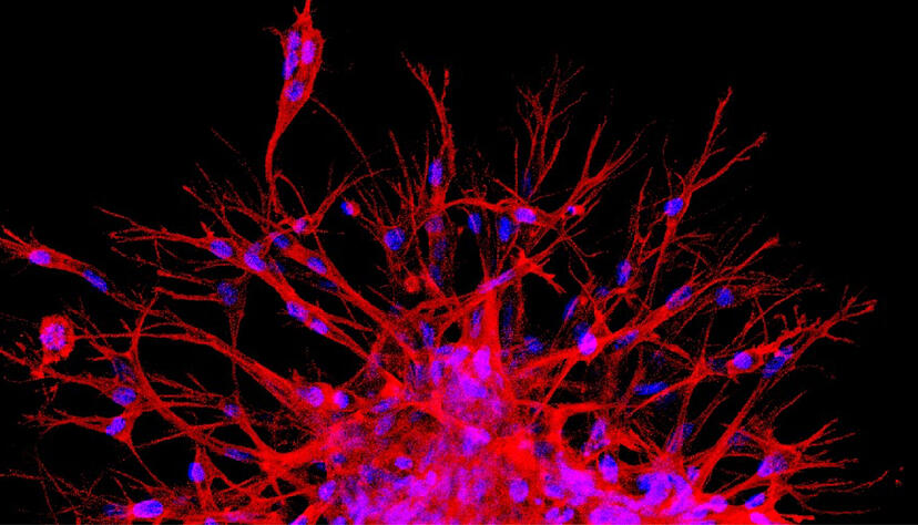 Max-Planck-Wissenschaftler untersuchen mithilfe magnetischer Nanopartikel, wie physikalische Kr&auml;fte das Wachstum neuer Blutgef&auml;&szlig;e beeinflussen. In dieser mikroskopischen Aufnahme sind winzige Blutgef&auml;&szlig;spr&ouml;sslinge (rot mit blauen Zellkernen) zu sehen, die aus dreidimensionalen Gewebemodellen mit kugelf&ouml;rmiger Struktur herauswachsen. Copyright: MPI f&uuml;r medizinische Forschung