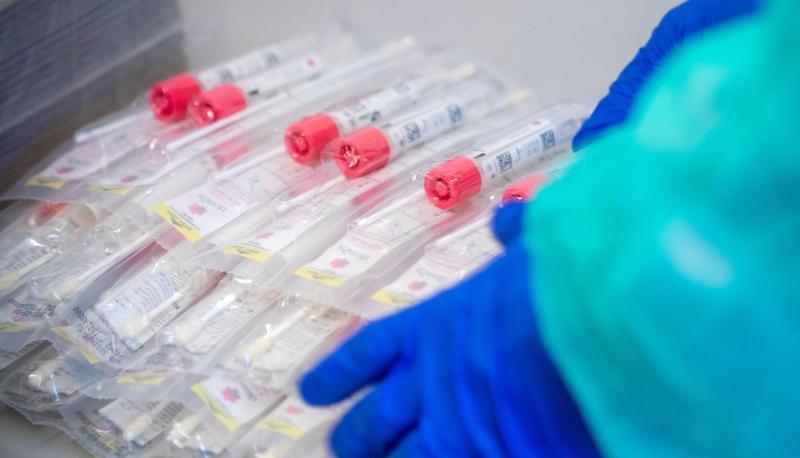 Testsets mit Abstrichstäbchen liegen in einem Testzentrum für Corona-Verdachtsfälle. Bürgertests werden voraussichtlich reaktiviert. Foto: dpa