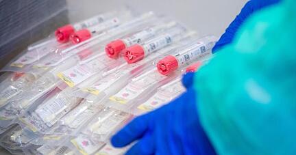 Testsets mit Abstrichstäbchen liegen in einem Testzentrum für Corona-Verdachtsfälle. Testsets mit Abstrichstäbchen liegen in einem Testzentrum für Corona-Verdachtsfälle.