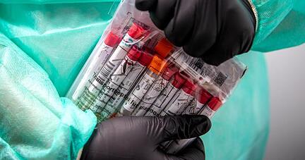 Proben für einen PCR-Test werden von einem Laboranten verpackt.