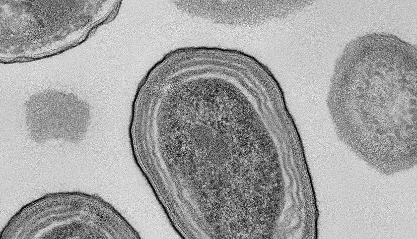 Elektronenmikroskopische Aufnahme von Prochlorococcus-Zellen.