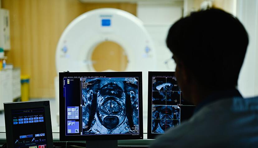 Nach dem Anfangsverdacht auf Prostatakrebs kommen im Verlauf einer Diagnostik auch bildgebende Verfahren zum Einsatz. (Archivbild)
