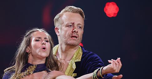 Ross Antony ist eine Runde weiter - obwohl ihm nach einem kleinen Unfall Blut &uuml;ber das Gesicht lief.