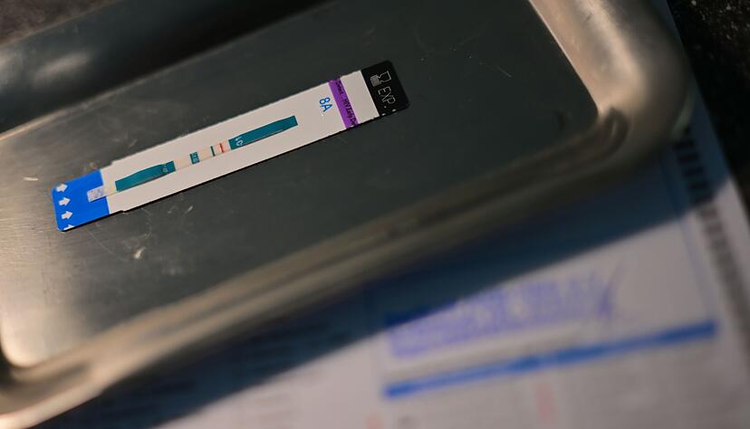 HIV-Diagnosen werden oft erst Jahre nach der Infektion gestellt. (Symbolbild)