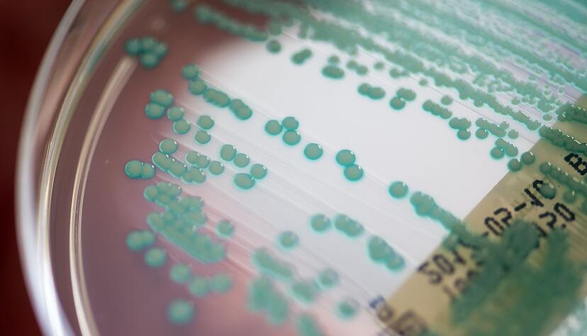 Eine Petrischale mit MRSA-Keimen, aufgenommen im Universit&auml;tsklinikum Regensburg.