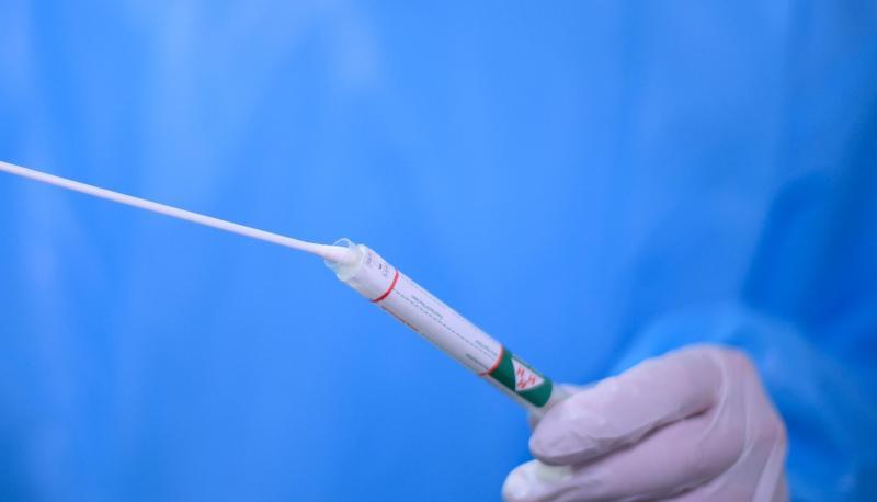 Ein Arzt hält einen Coronavirus-Test in den Händen. Ein Arzt hält einen Coronavirus-Test in den Händen.