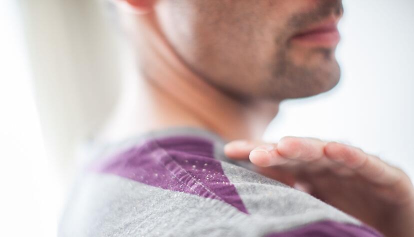 Rieseln wie feiner Schnee auf die Schultern: Trockene Schuppen entstehen, wenn die Kopfhaut nicht ausreichend mit Feuchtigkeit versorgt ist. Rieseln wie feiner Schnee auf die Schultern: Trockene Schuppen entstehen, wenn die Kopfhaut nicht ausreichend mit Feuchtigkeit versorgt ist.