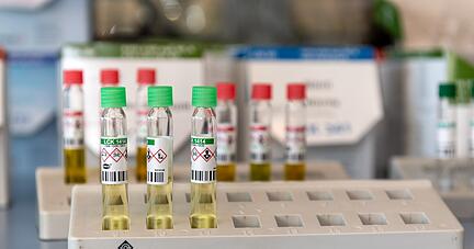 Im Hohenlohekreis wird noch kein Abwasser auf Coronaviren untersucht. Im Hohenlohekreis wird noch kein Abwasser auf Coronaviren untersucht.