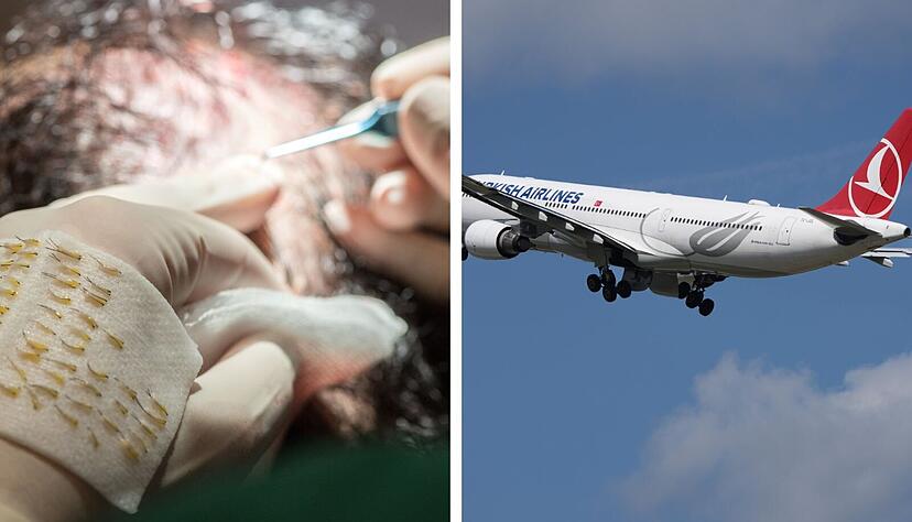 Die T&uuml;rkei ist das Ziel vieler Medizintouristen. Vor allem Haartransplantationen f&uuml;r M&auml;nner sind dort deutlich billiger als in Deutschland.